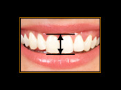 cosmetic dentistry youthful smile