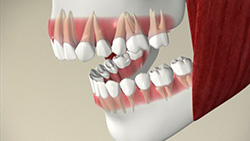 Overview of Orthodontic Problems