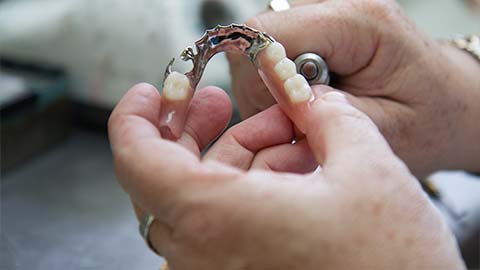 Partial Denture