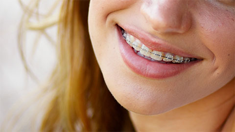 Overview of Orthodontic Problems